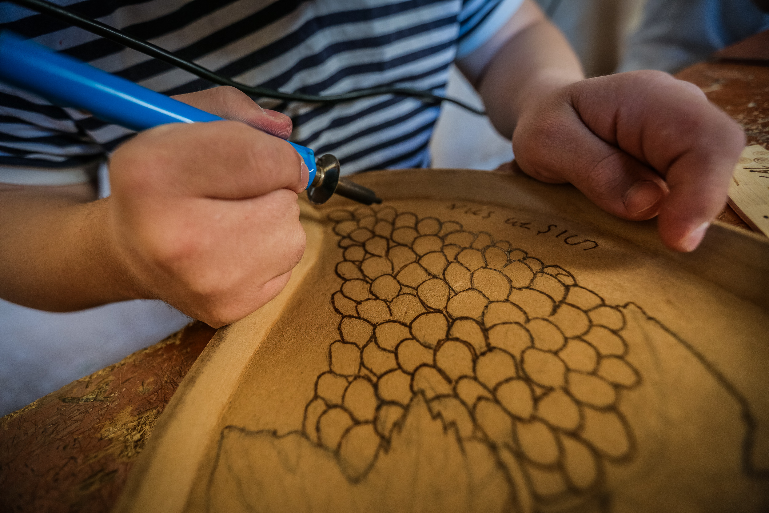 Daun sindromlu Nuru oymanın “dağlama” növündən üzüm şəklini çəkir