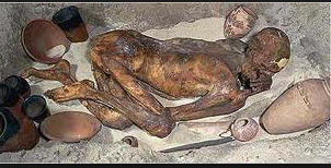 Fetus formalı mumiya