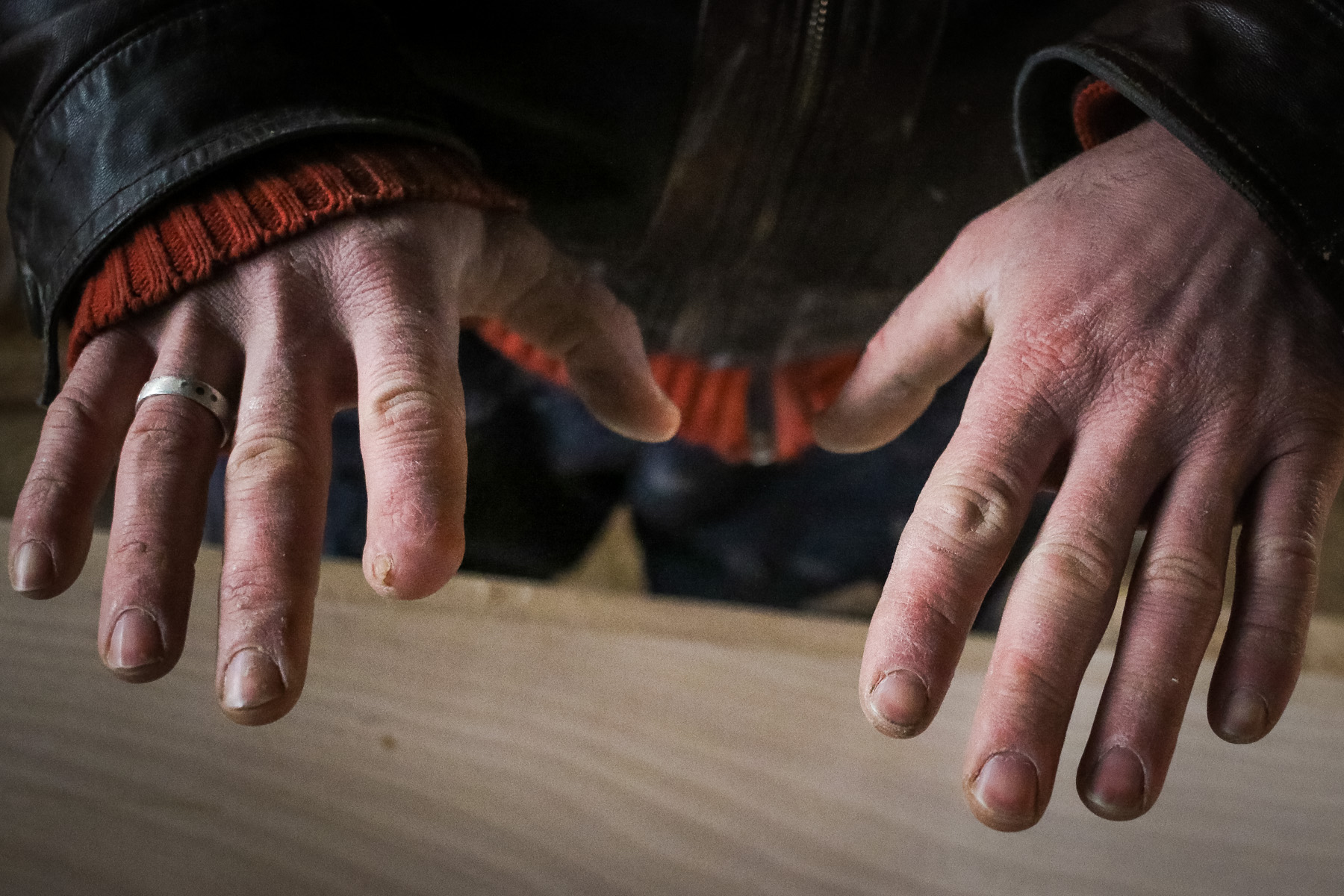 Şahin usta dəzgahda işləyərkən ehtiyatsızlıqdan barmağının bir hissəsini itirir