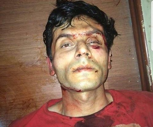 Юнис Сафаров, обвиняемый в покушении на главу ИВ Гянджи