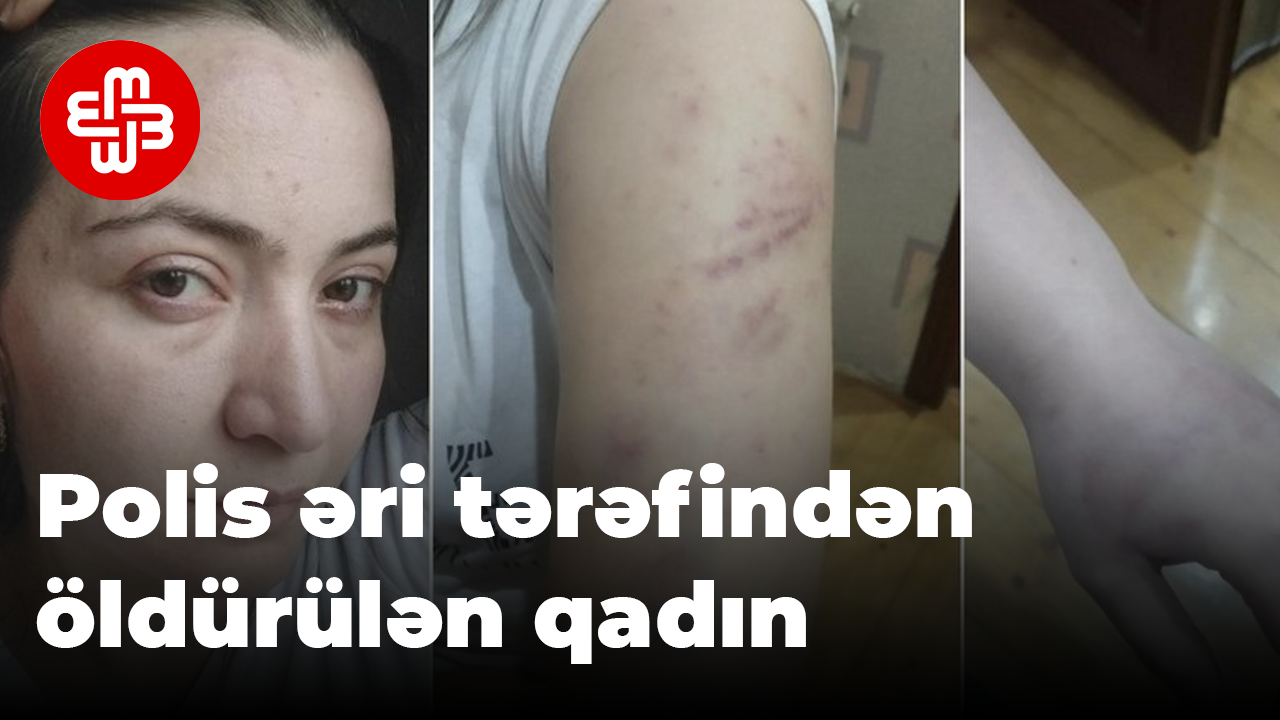 ”Uşaqların yanında qızıma 7 güllə vurub”