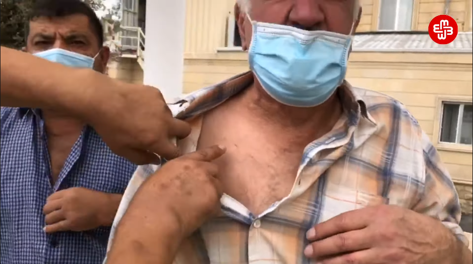 Dializ xəstələri etiraz edir: “Sanki bizi ölümə göndərirlər”