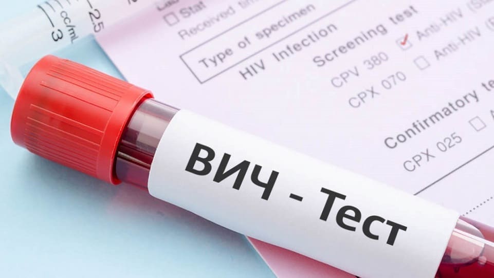 ВИЦ-инфекция